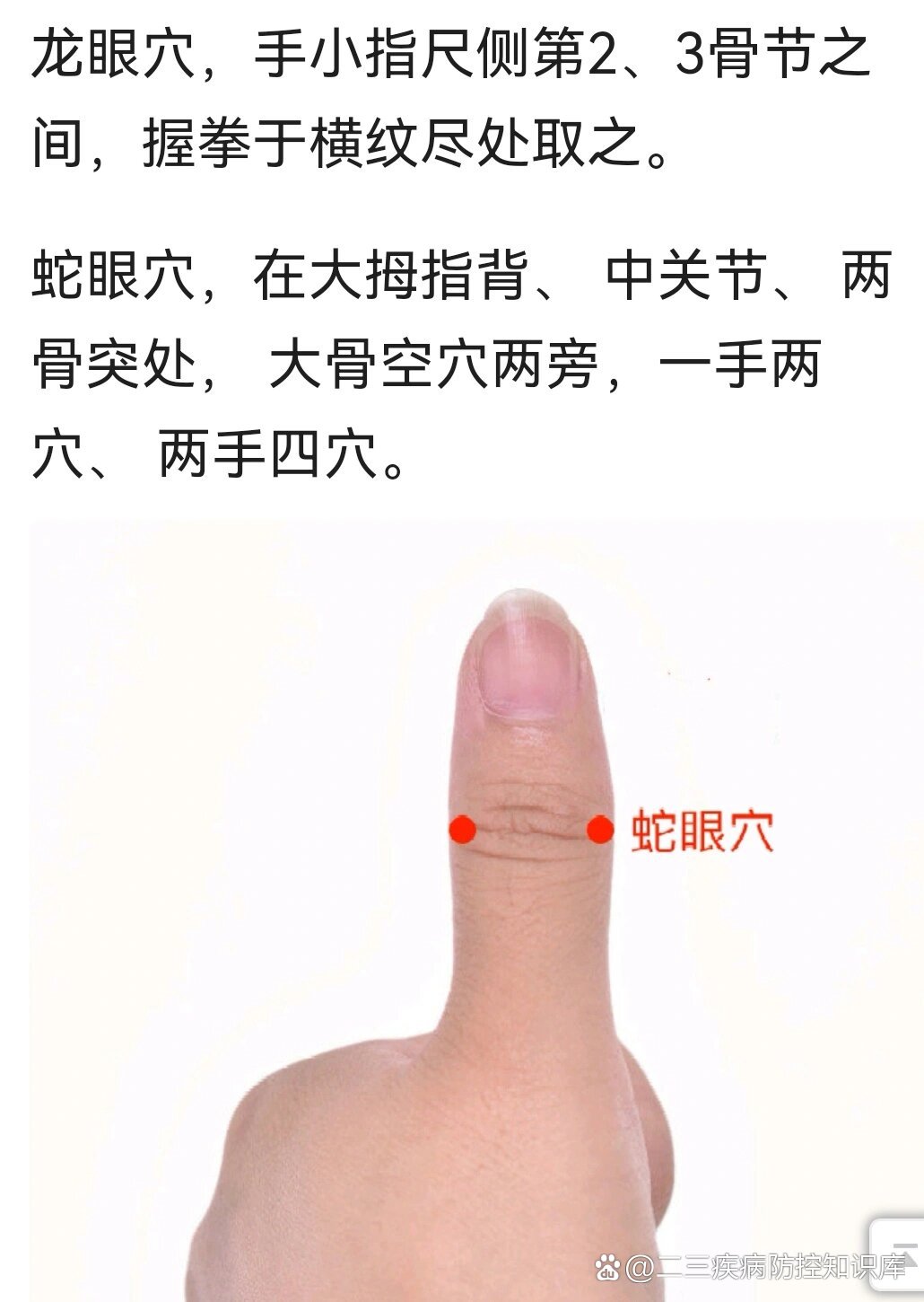 带状疱疹(蛇缠腰)的治疗4刺血法