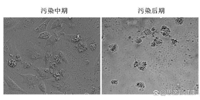 细胞培养细菌污染图片