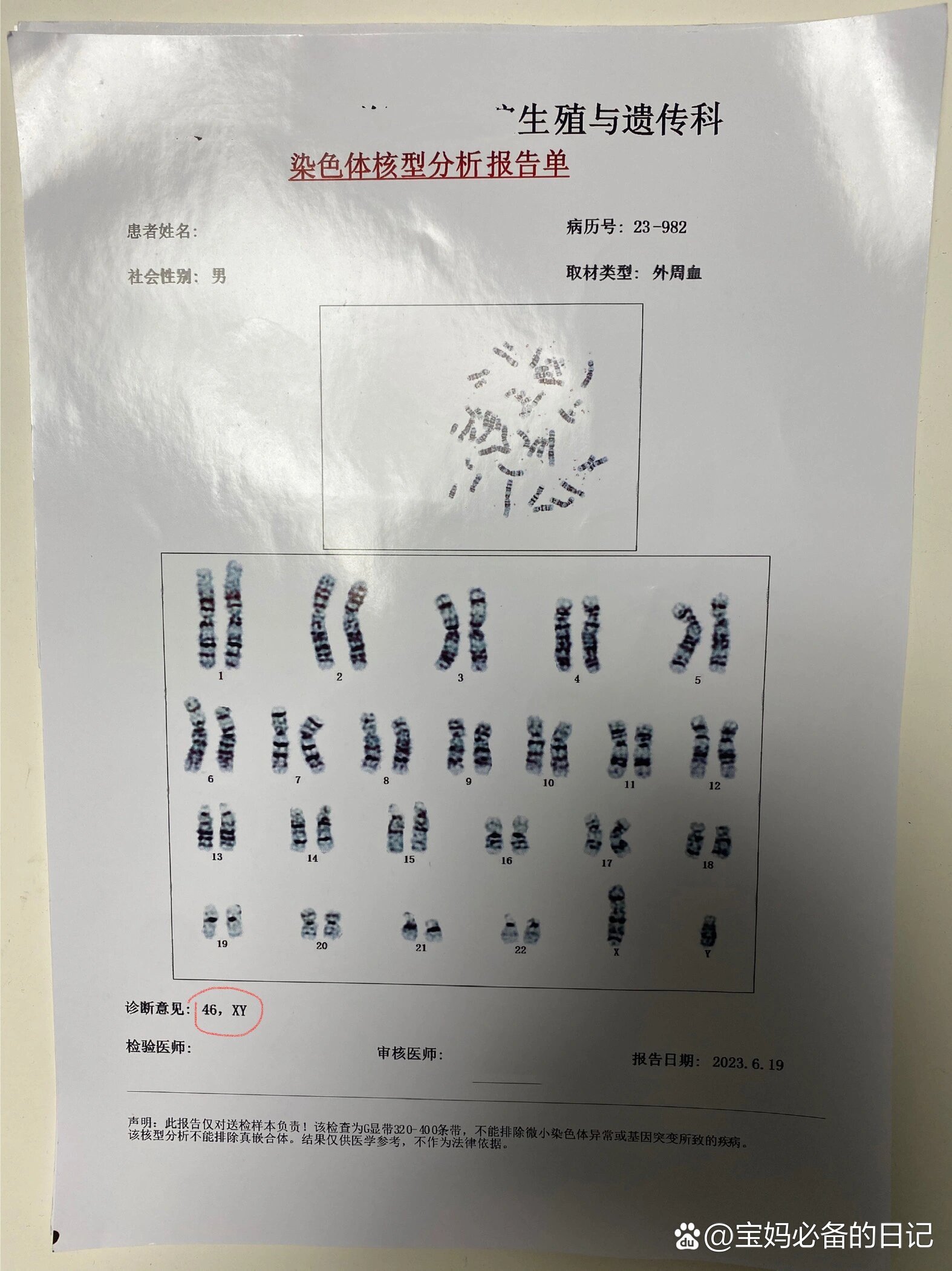 染色体结果出来了,胚胎三倍体