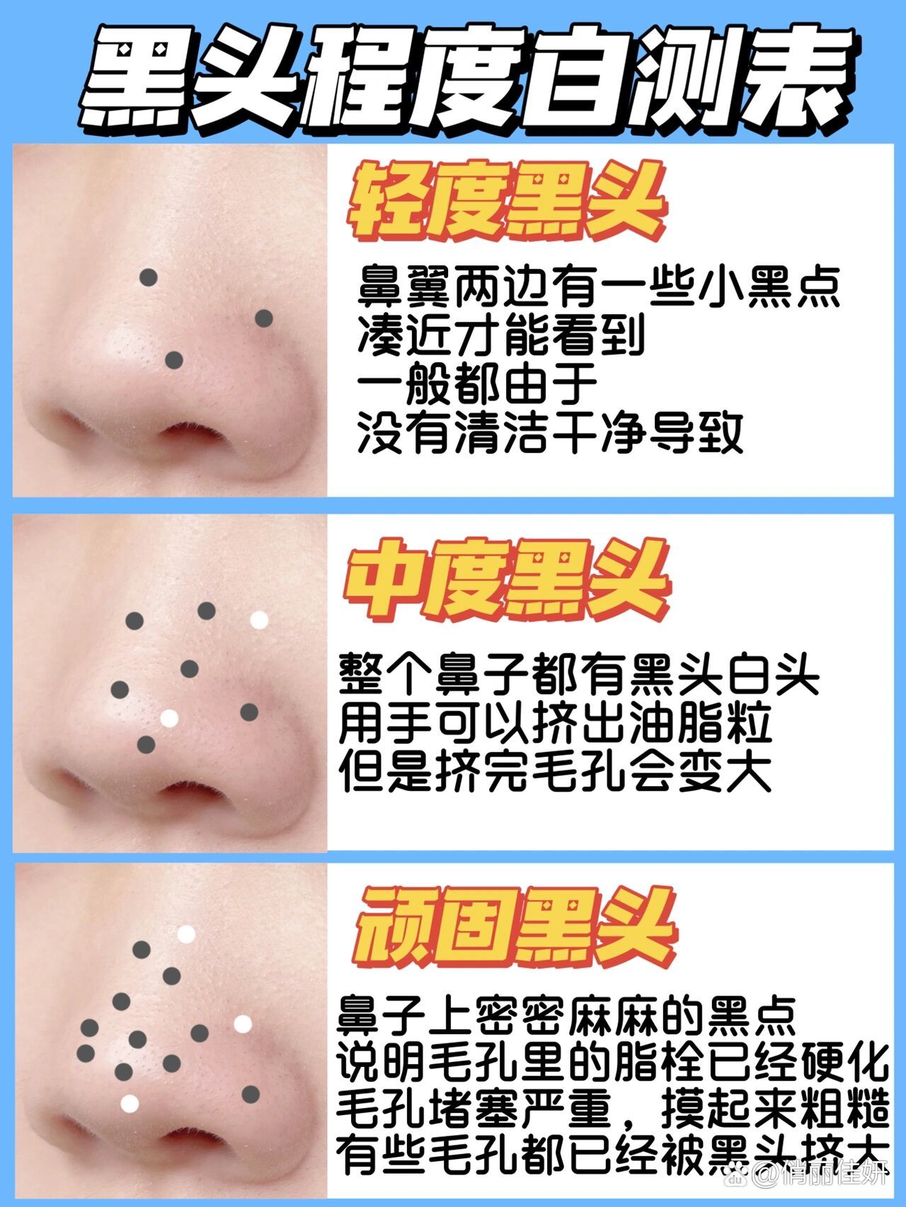 黑头鼻成功翻身!