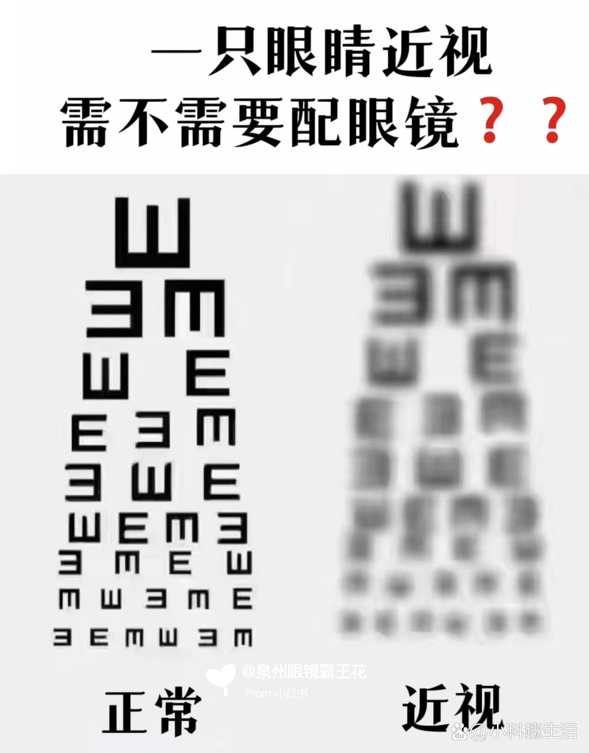 一只眼近视,一只眼没近视,需要戴眼镜吗❓