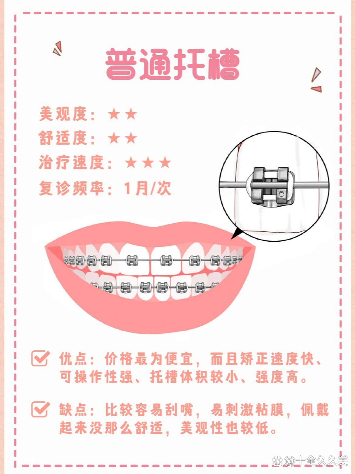 美国ormco自锁托槽介绍图片