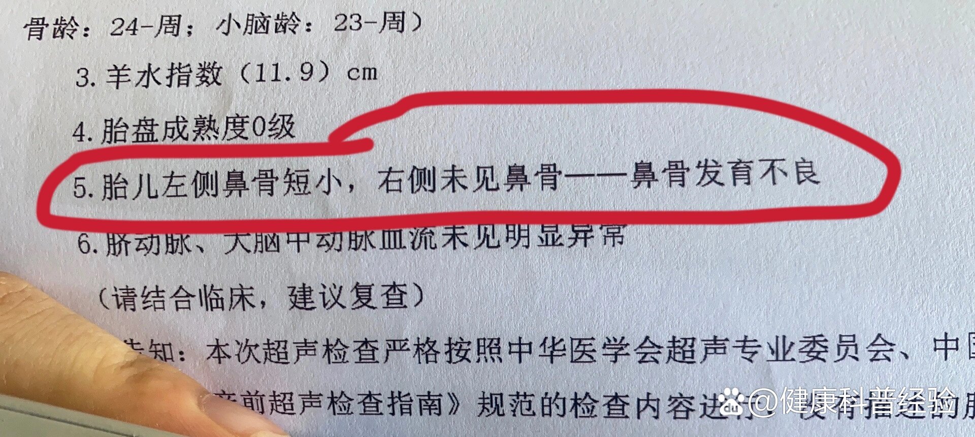 鼻骨发育不良照片图片