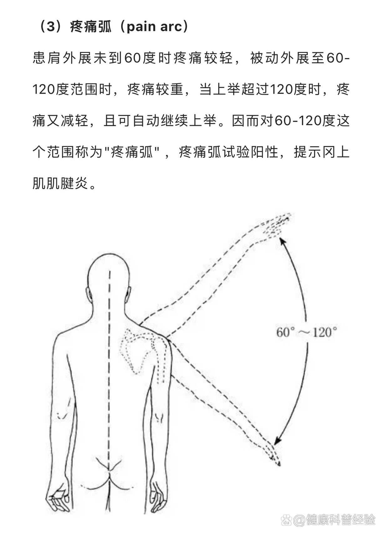 肩关节活动度检查图片