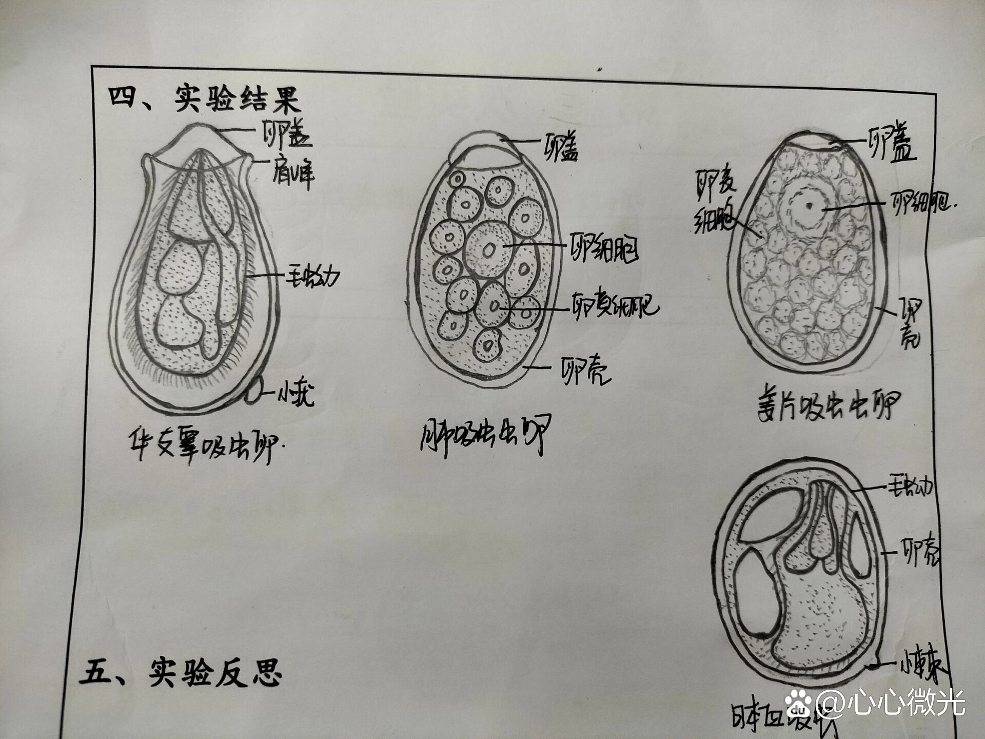 彩蚴吸虫 解剖图片