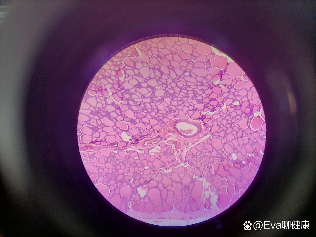 p>甲状腺 br>100*和400*切片 /p>