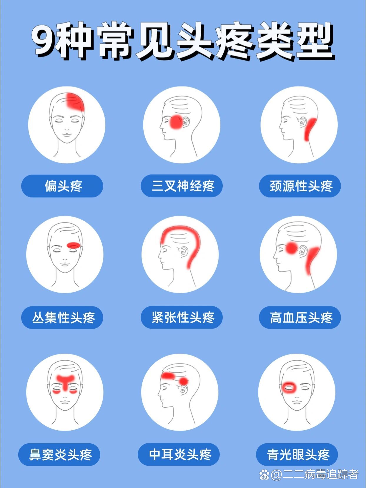不同部位头疼常见原因77缓解小妙招6015