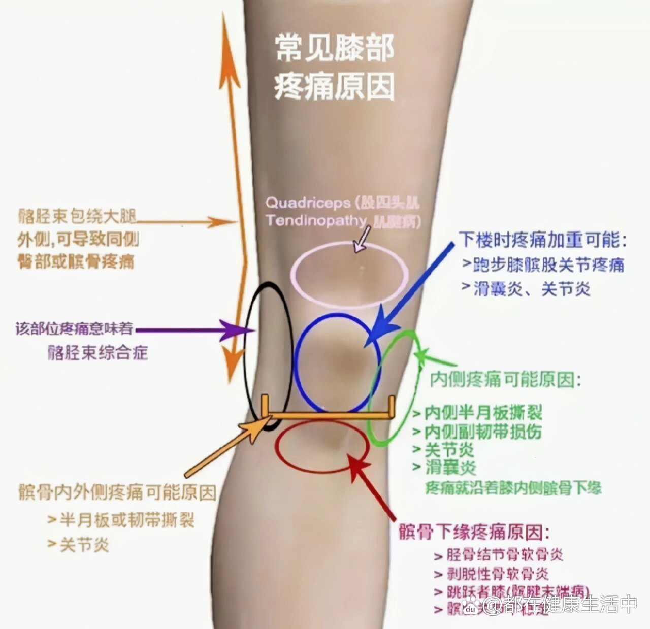 膝盖疼是怎么回事图片