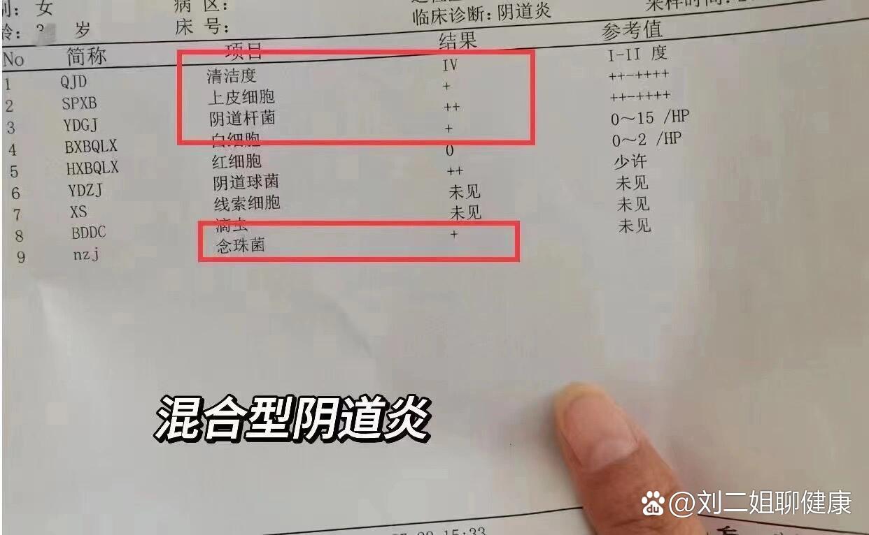 正常白带清洁度是1-2度,出现3-4度都是有细菌感染,炎症的表现91报告