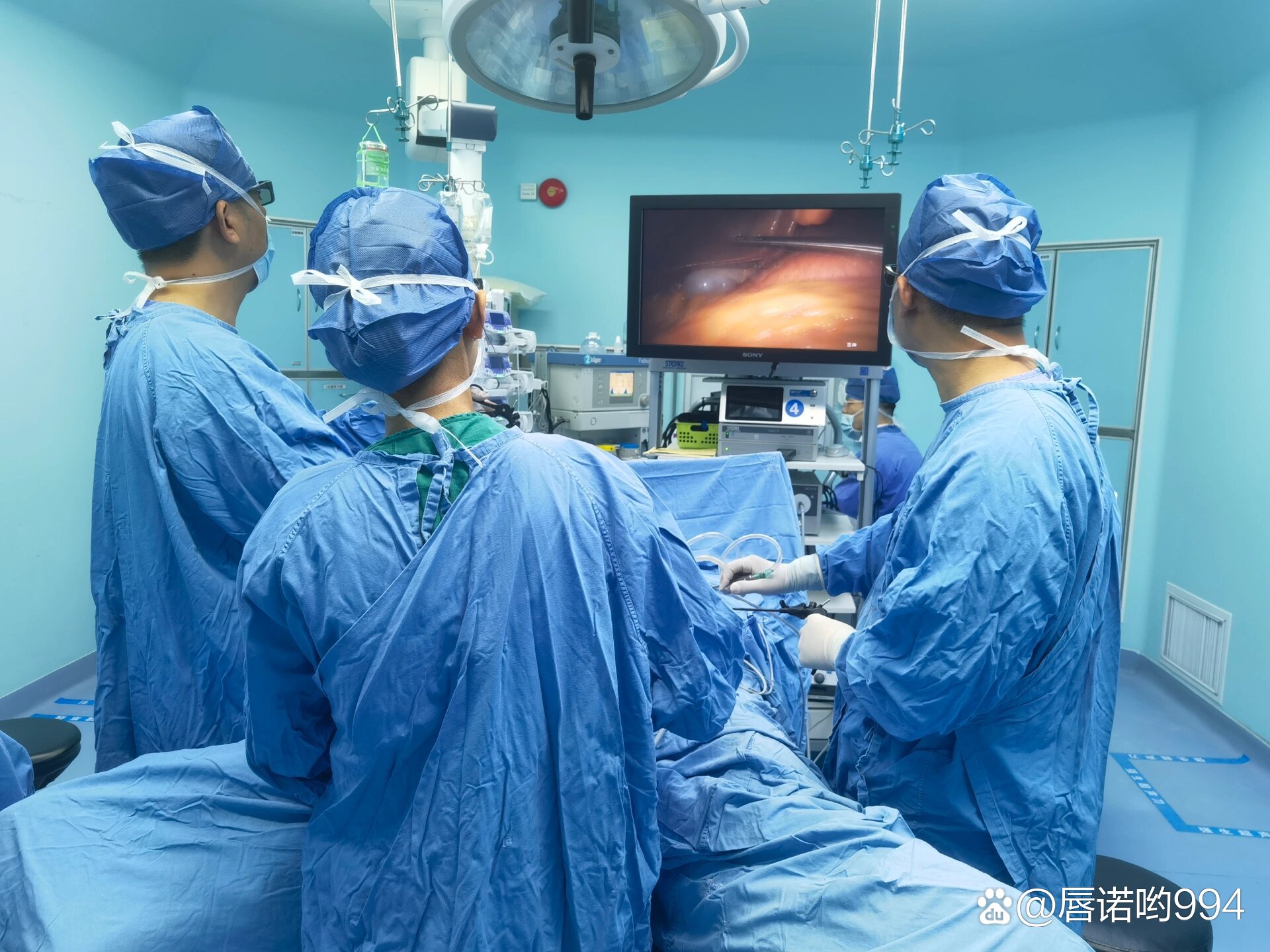 第一次腹腔镜远端胃癌根治术