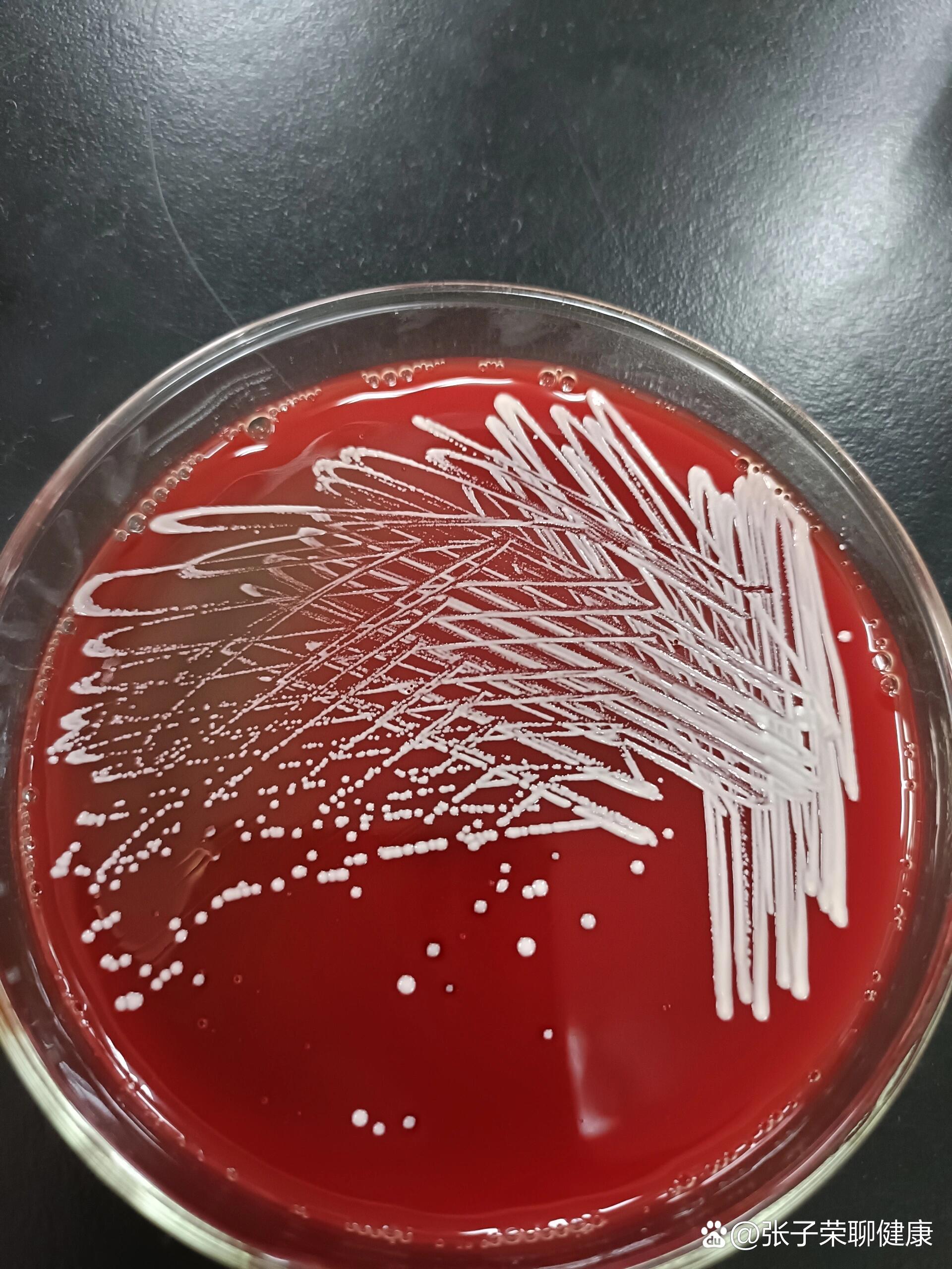  br>革兰阳性球菌,触酶阳性,of试验氧化型,新生霉素耐药,dna酶阴性.