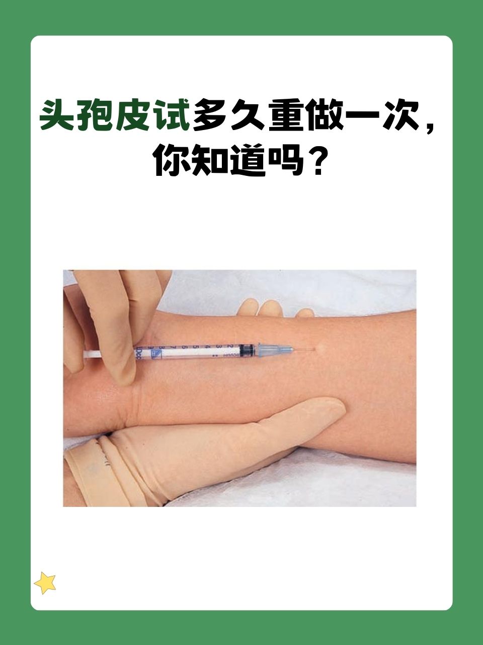 头孢皮试多久重做一次,你知道吗?