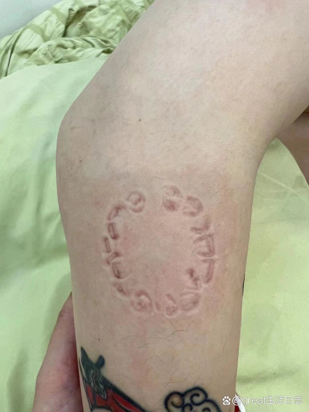  p>这口咬得很实在  牙印子纹身图案 /p>