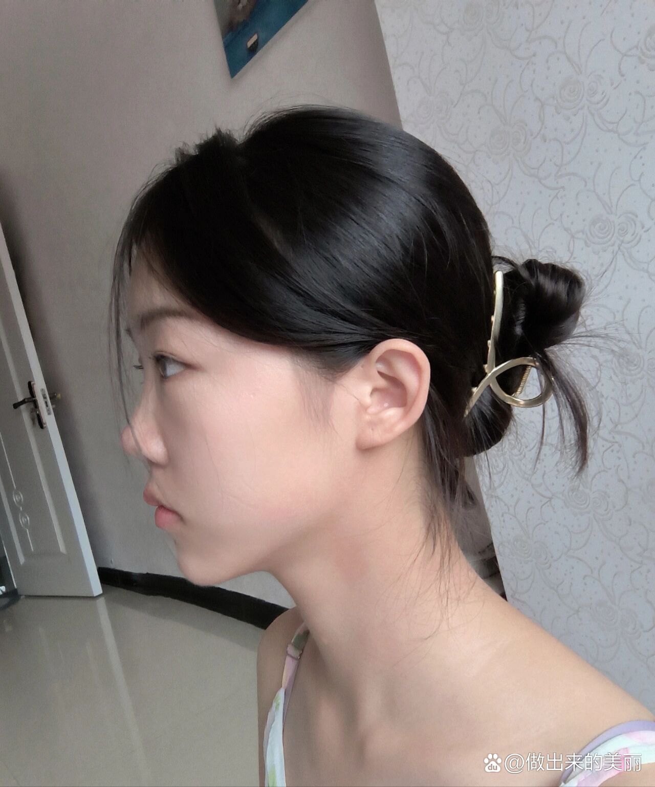 几乎没有山根是种什么体验妈生的鼻子👃🏻,无山根版蒜头鼻