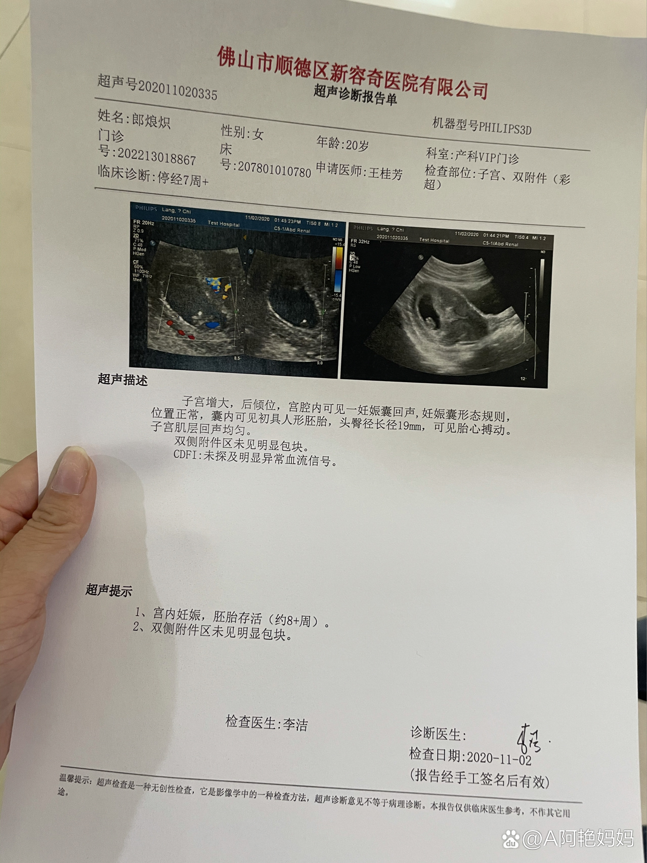 8周孕早期b超单