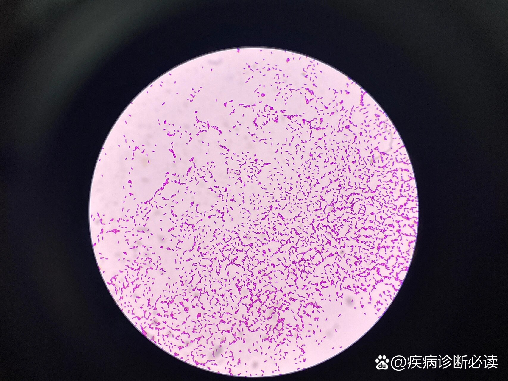 产气克雷伯菌图片