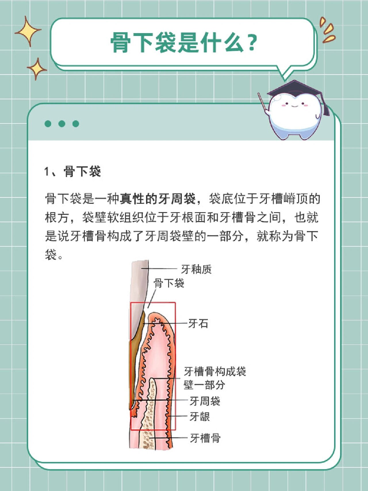 袋壁软组织位于牙根面和牙槽骨之间,也就是说牙槽骨构成了牙周袋壁的