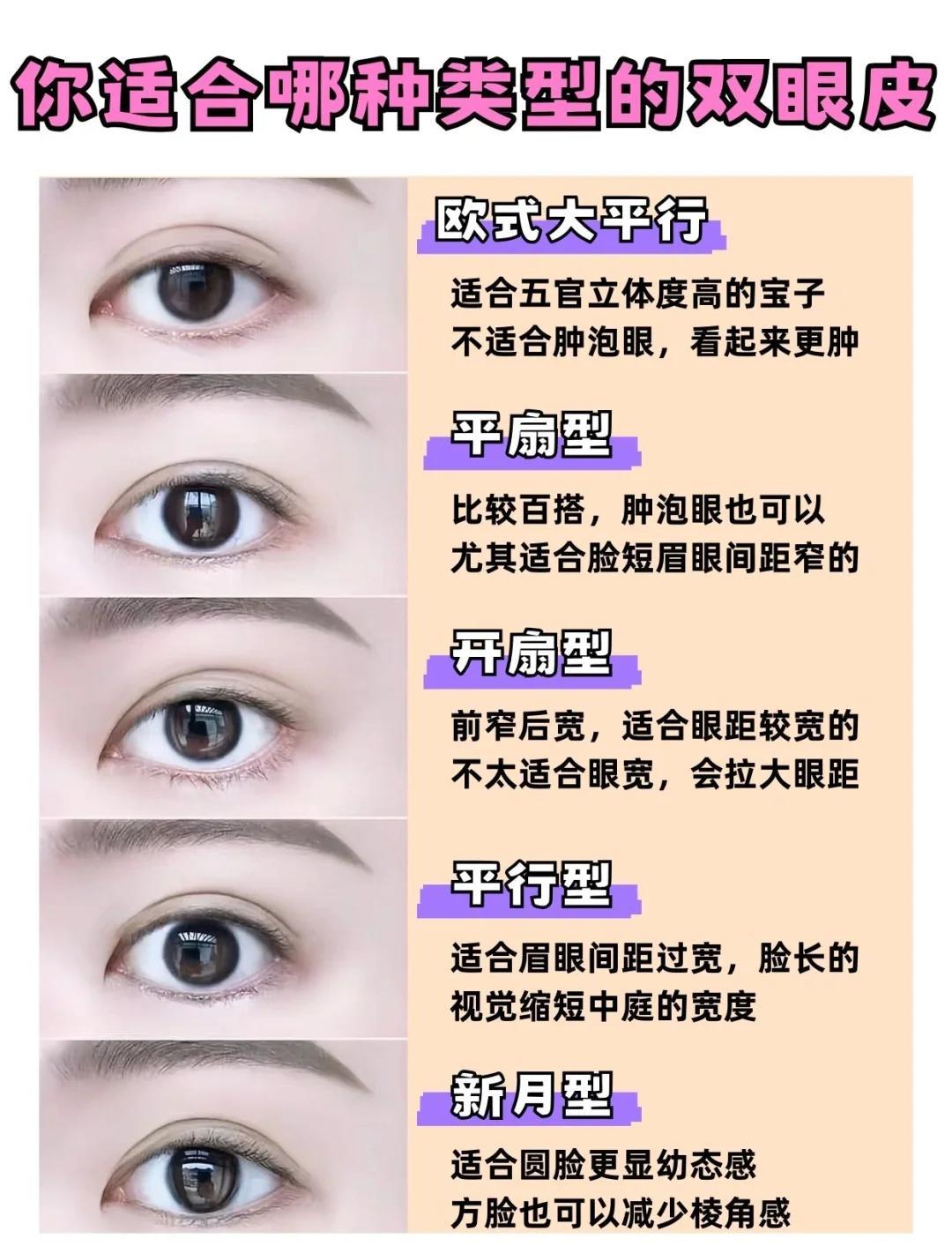 双眼皮类型与宽度选择指南
