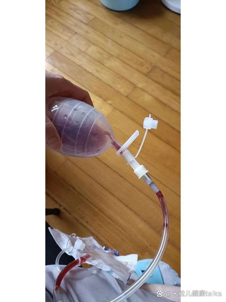 求助,引流管堵住了怎么办