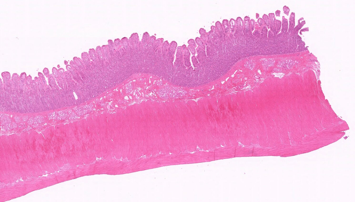 材料与方法:人十二指肠,zenker液固定,石蜡包埋,切片,he染色