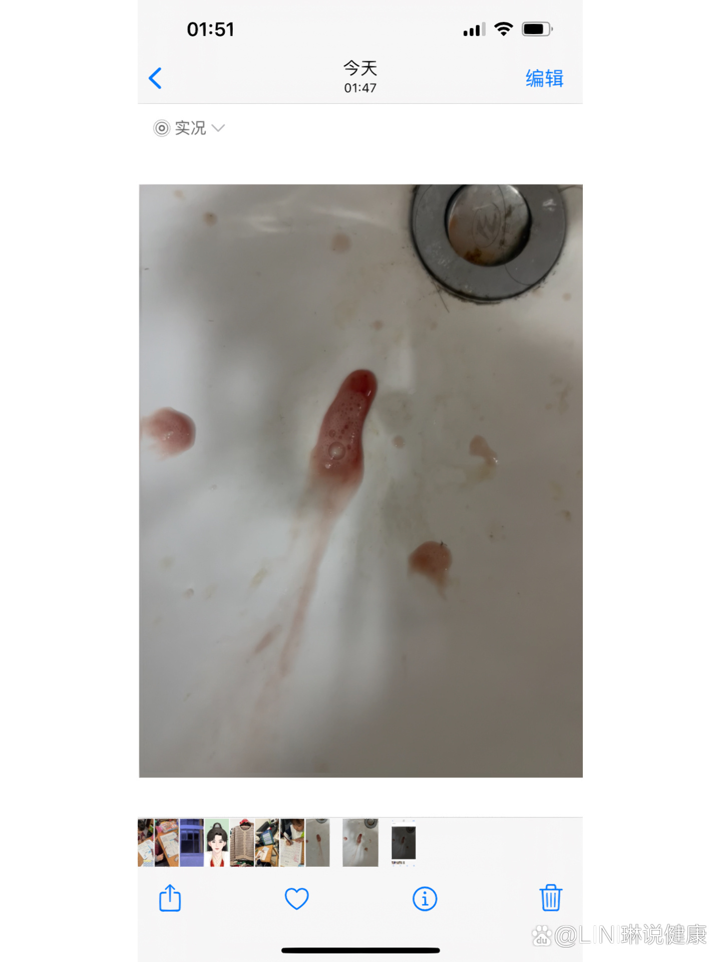 为什么吐口水会有血生病了吗百科在线