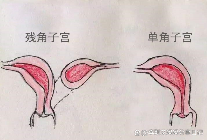 母兔子宫位置图片图片