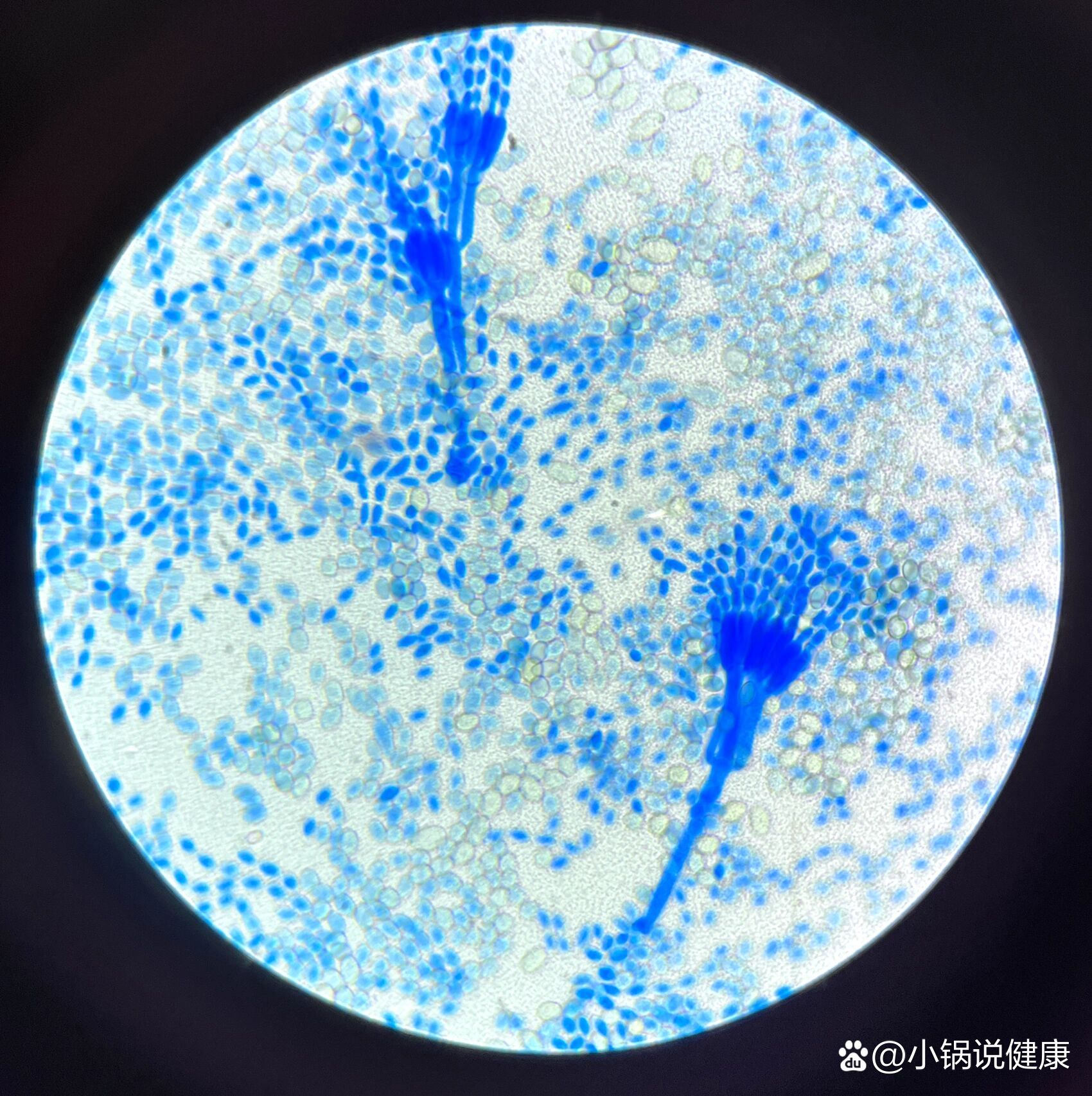 青霉菌落形态特征图片