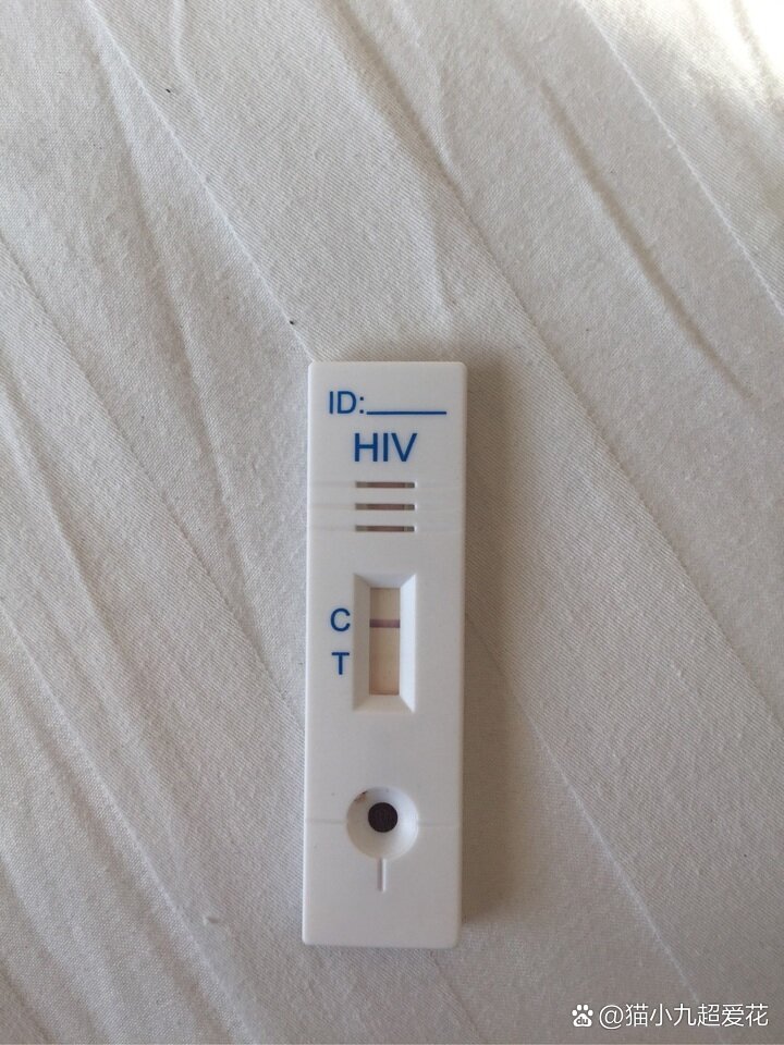 hiv检测图片图片