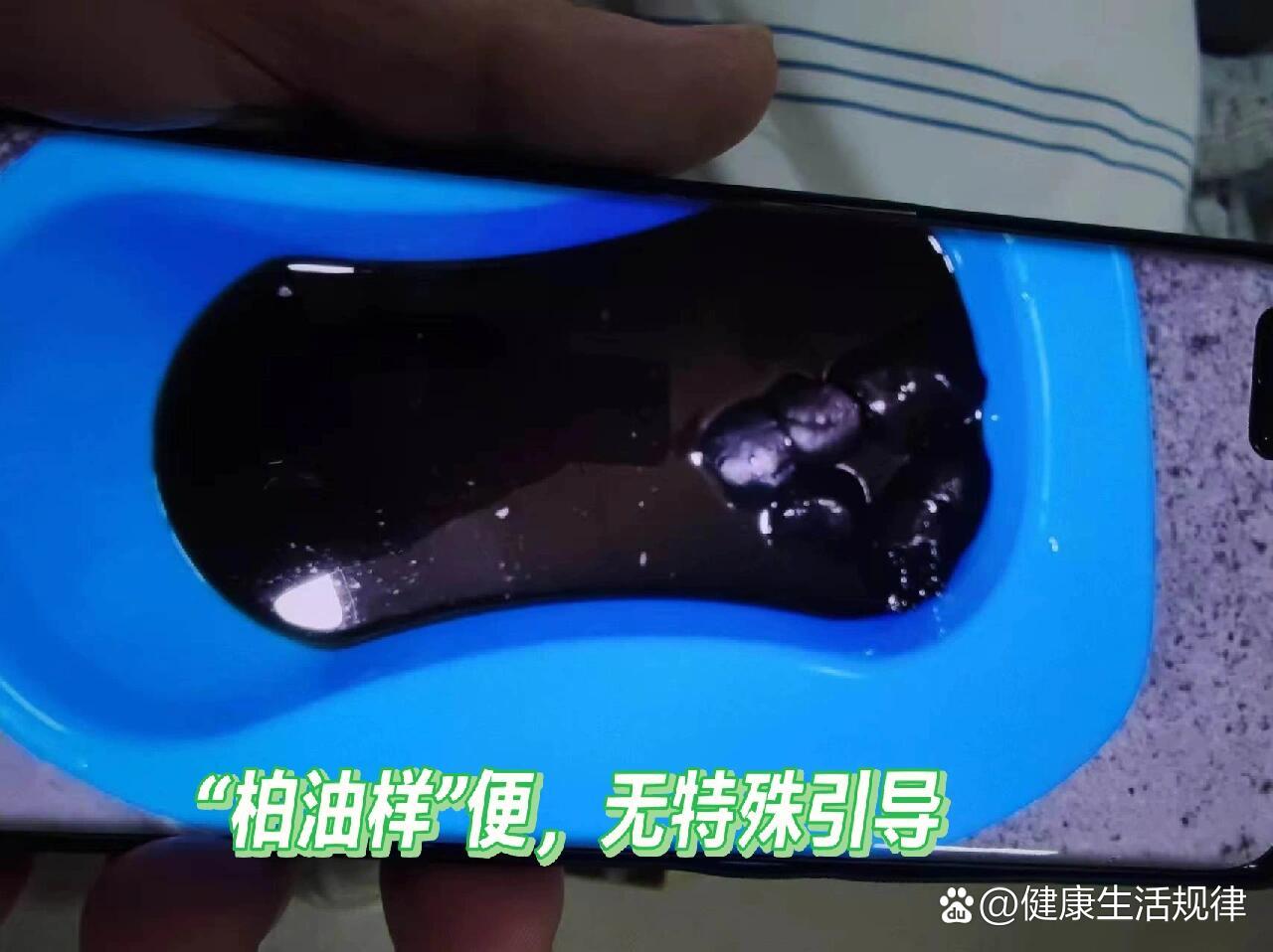 为什么屎是黑色