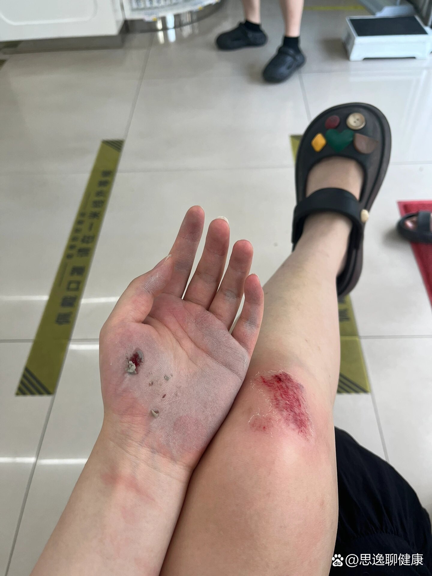 孕初期,孕期第一摔,算是宝宝的第一个小挫折