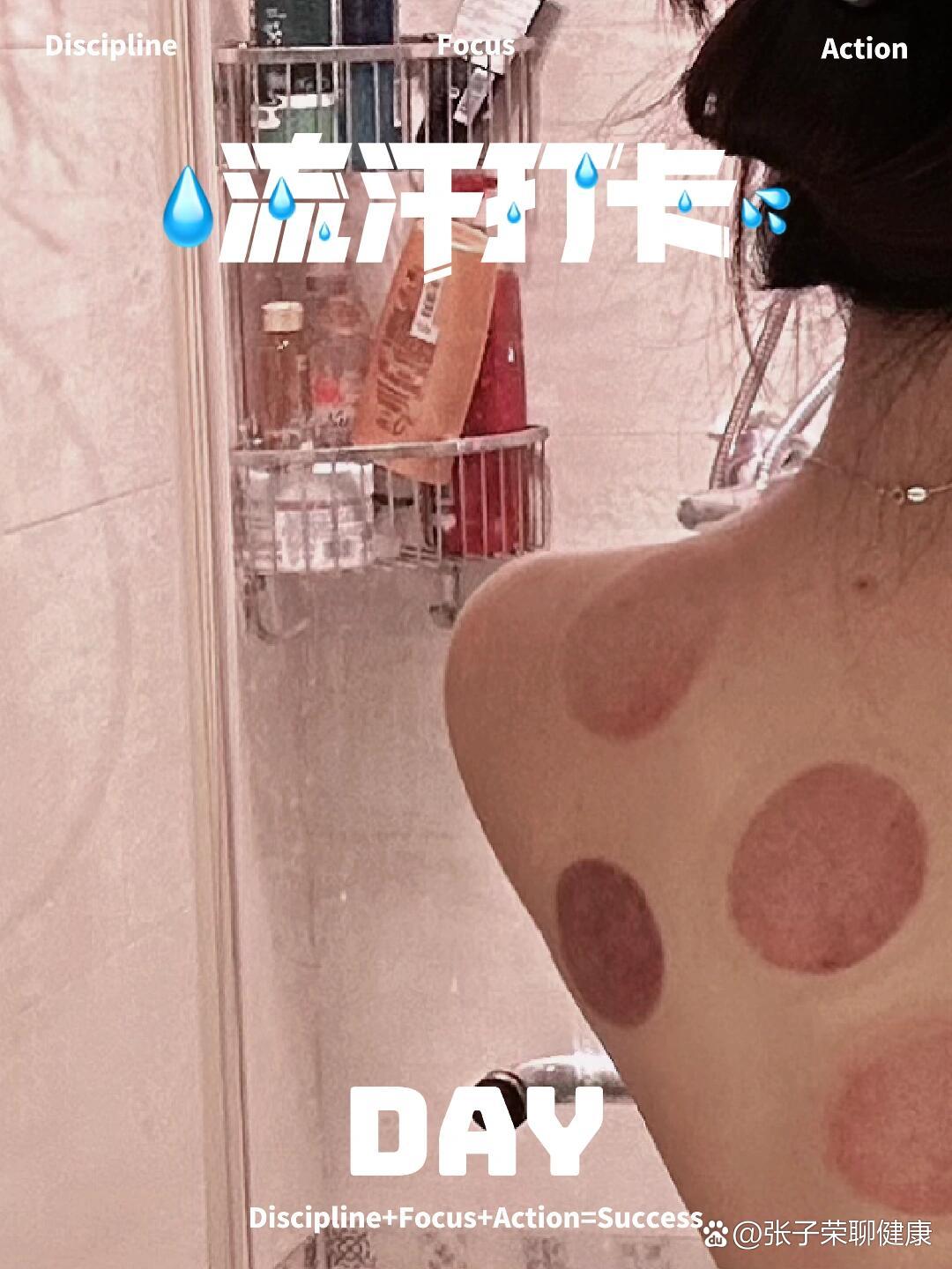 拔罐6小时内能不能洗澡