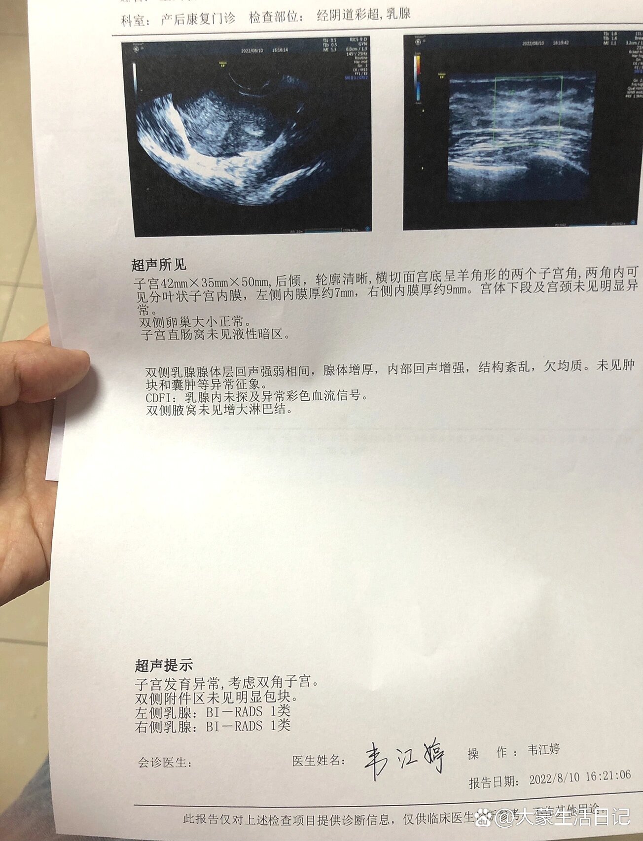 给双角子宫,纵隔子宫的姐妹们一些信心