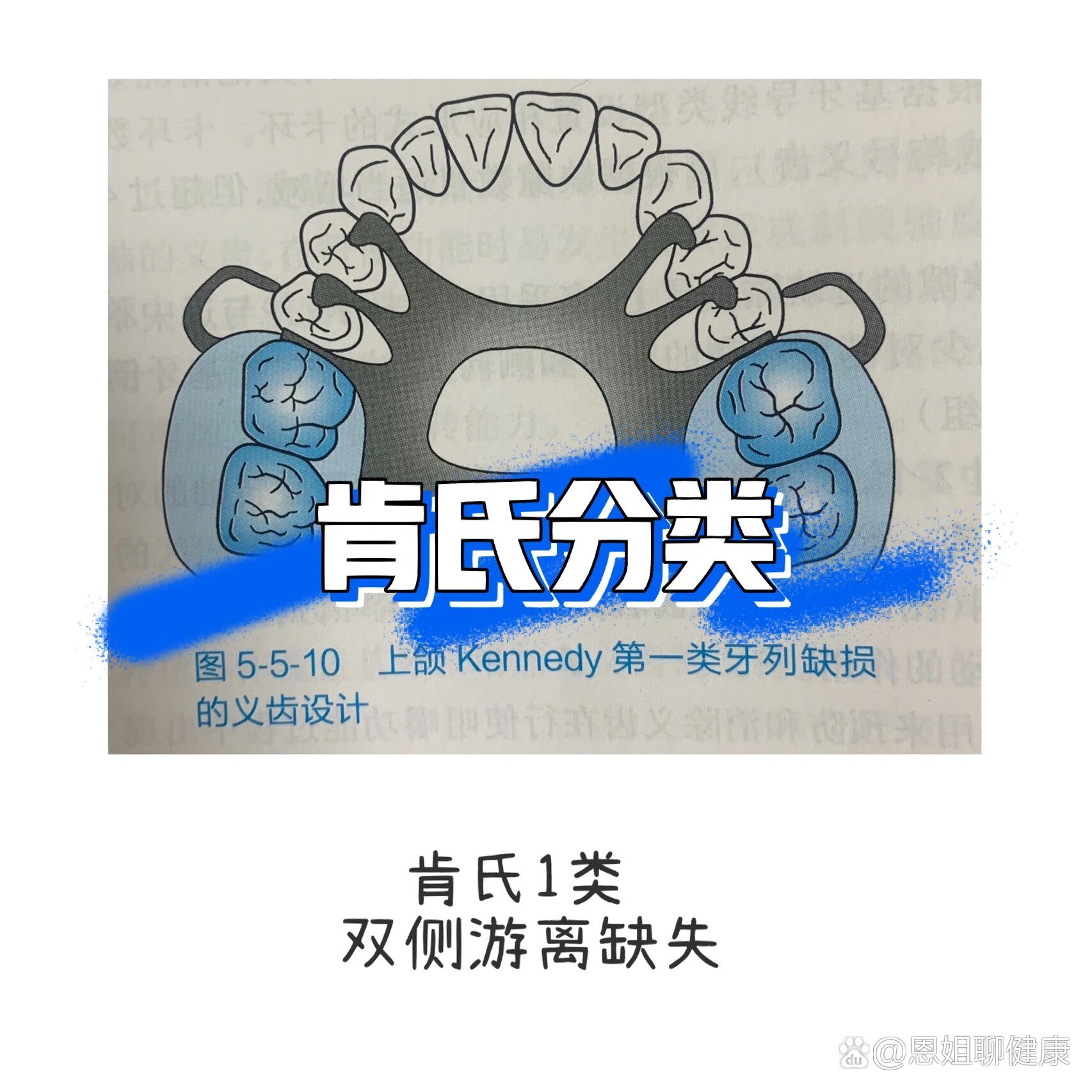 肯氏分类彻底懂了