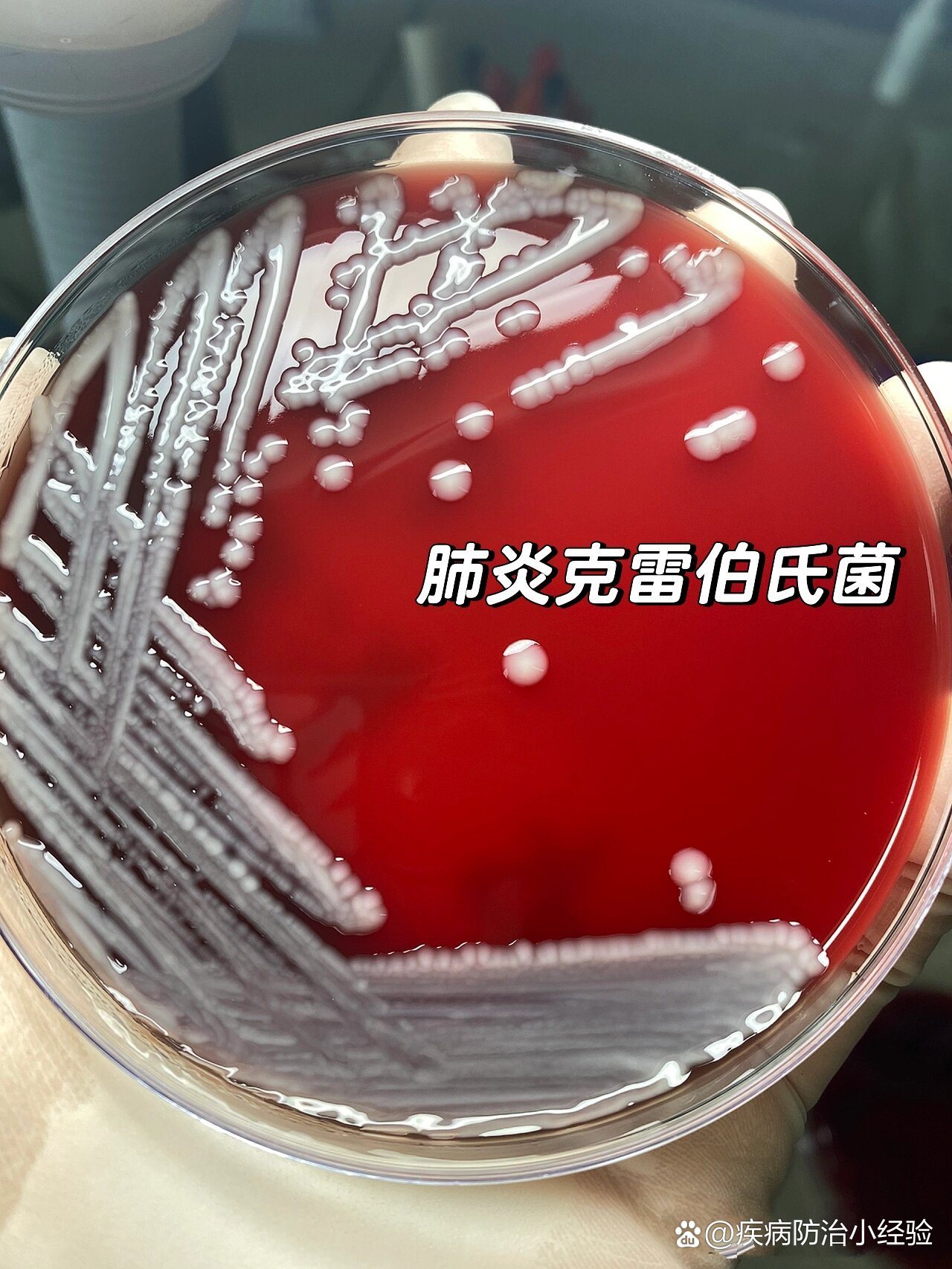 肺炎克雷伯氏菌