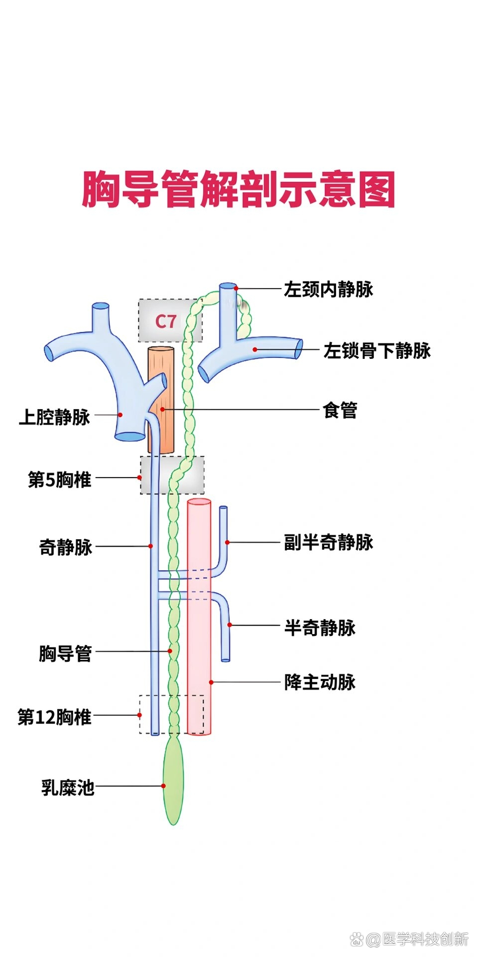 导管的手绘图图片