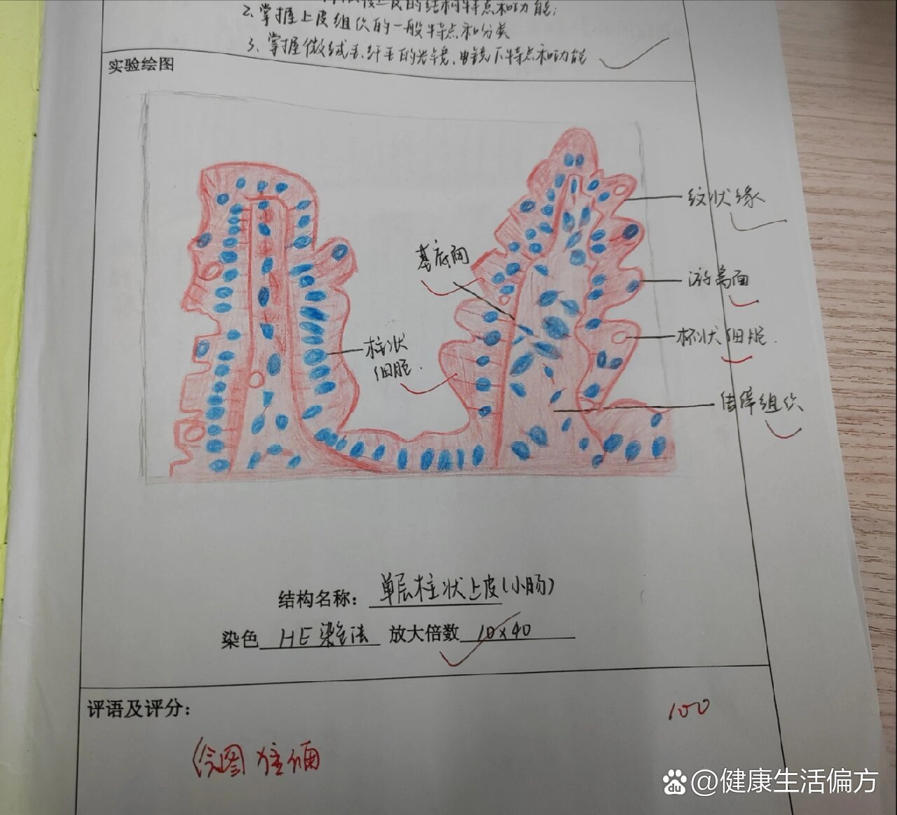 单层柱状上皮游离面图片