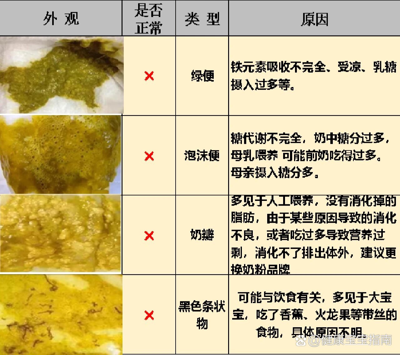 宝宝大便类型全解