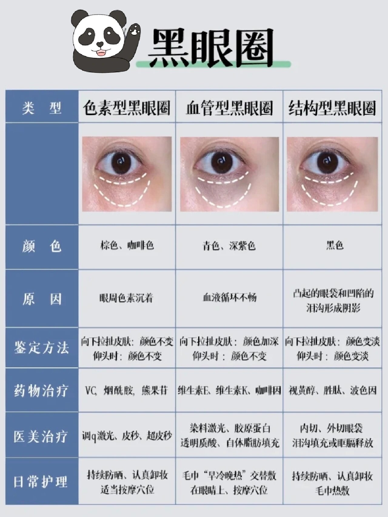 黑眼圈颜色分类图片