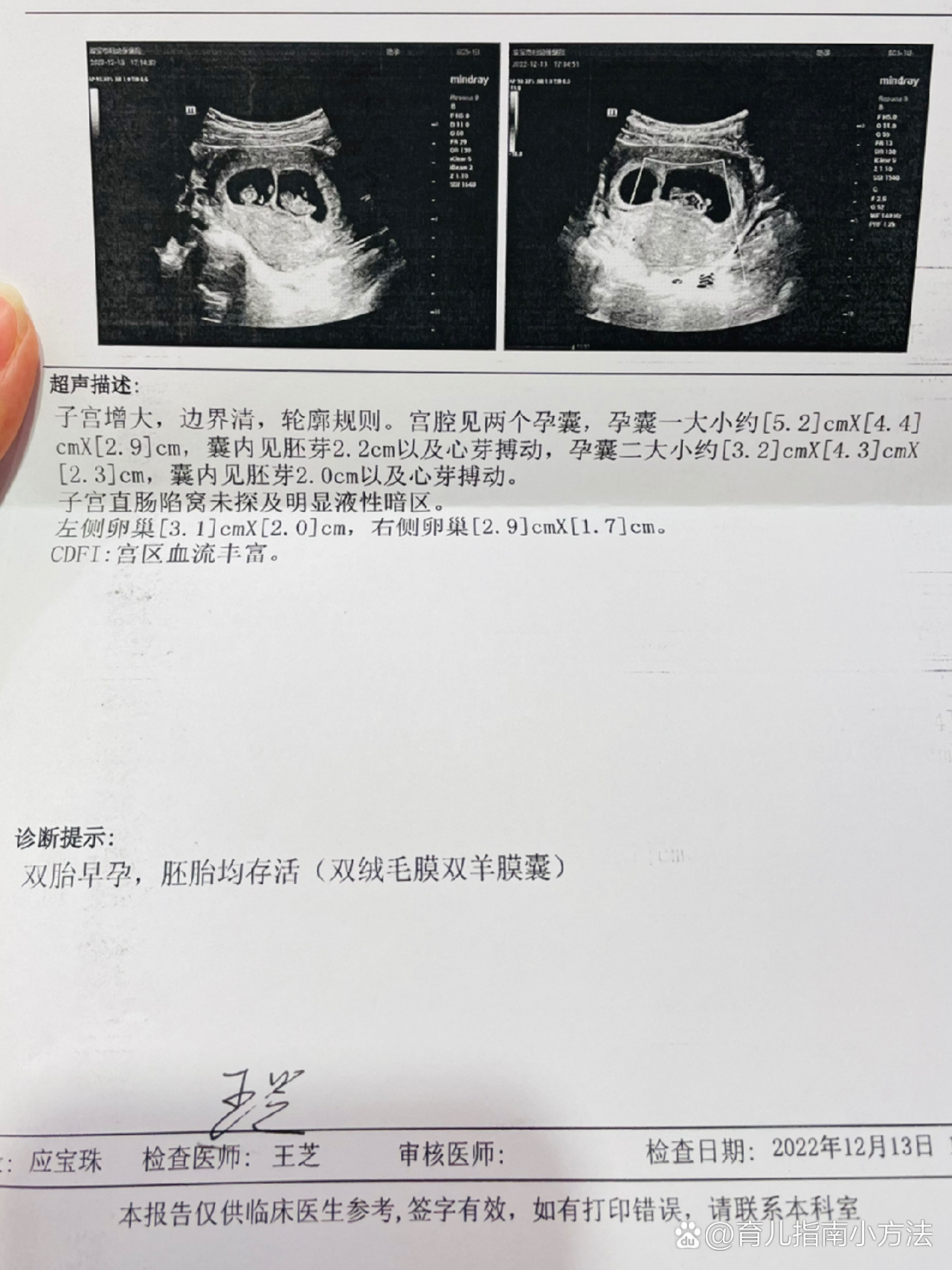 双绒毛膜双羊膜囊,大概就是常年健身的好处