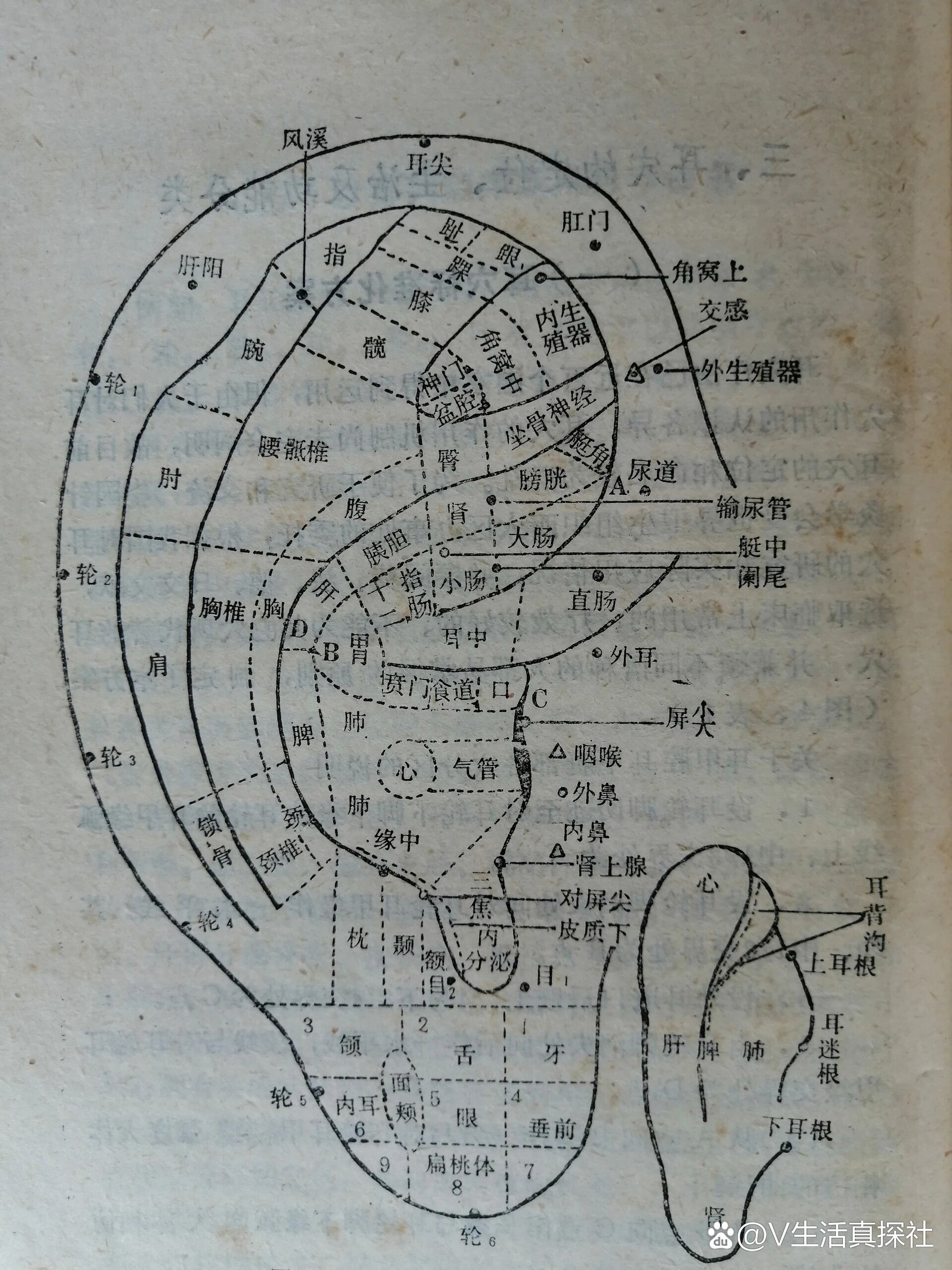 耳诊图 口诀图片