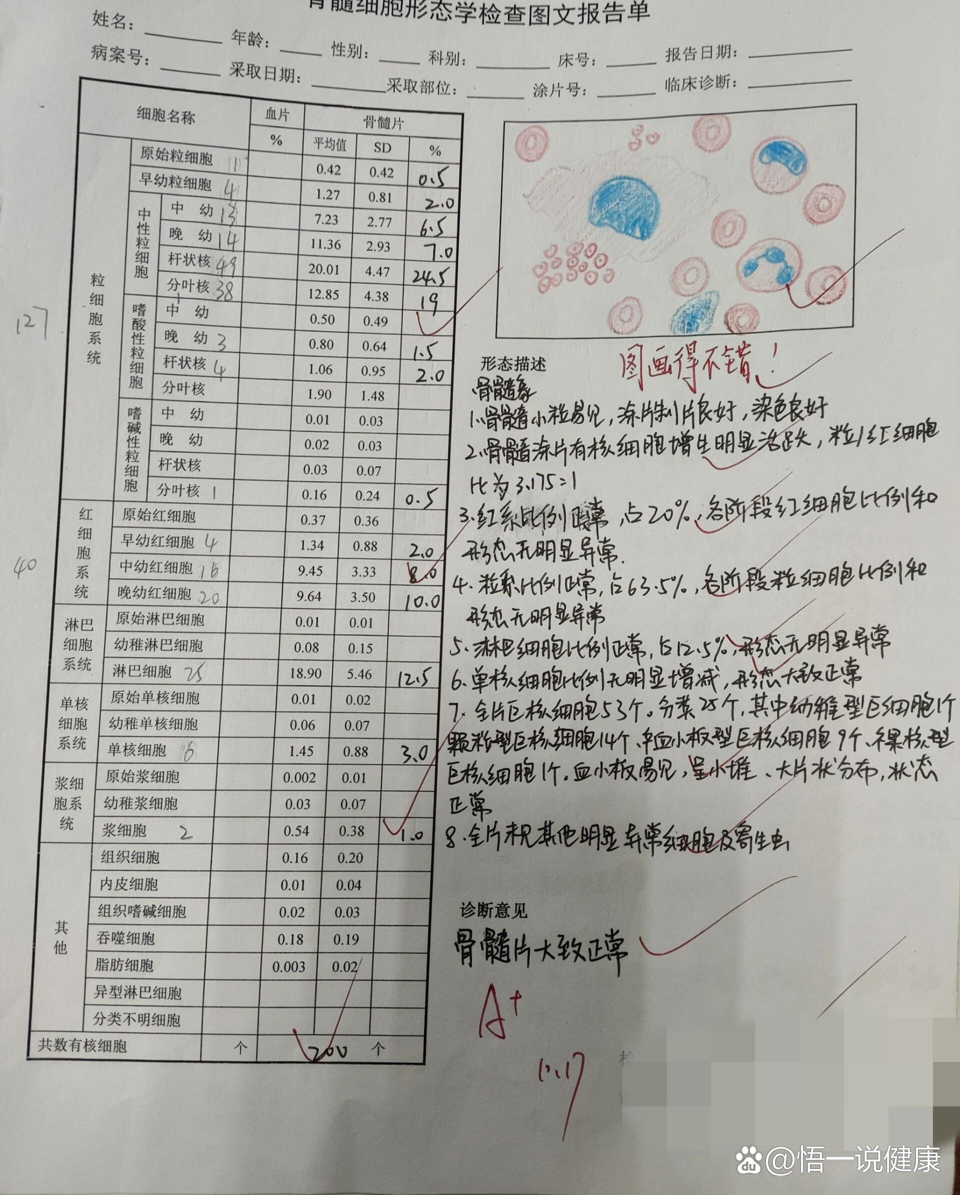 骨髓涂片报告图片