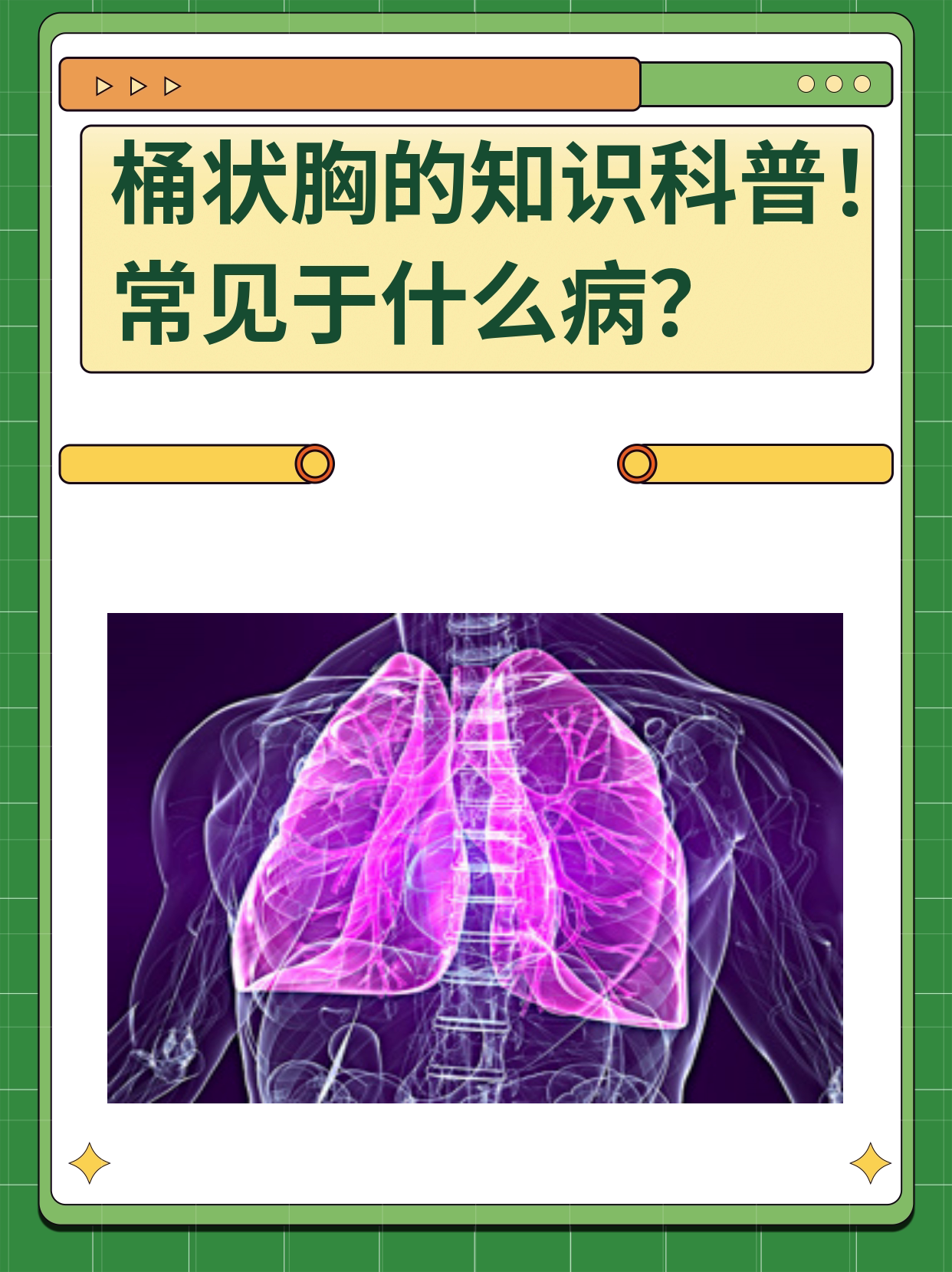 正常的胸桶状胸图片