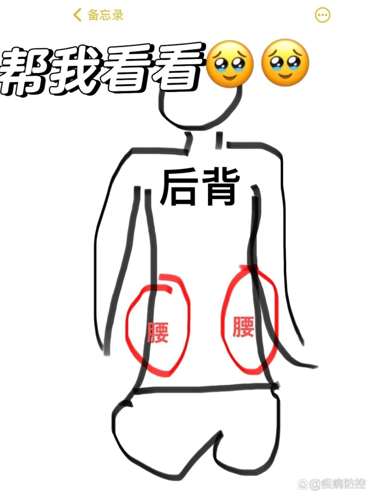 女性腰尾部骨头凸起图片