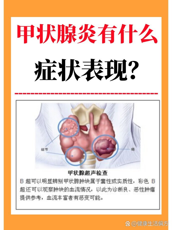 甲状腺炎有什么症状表现?