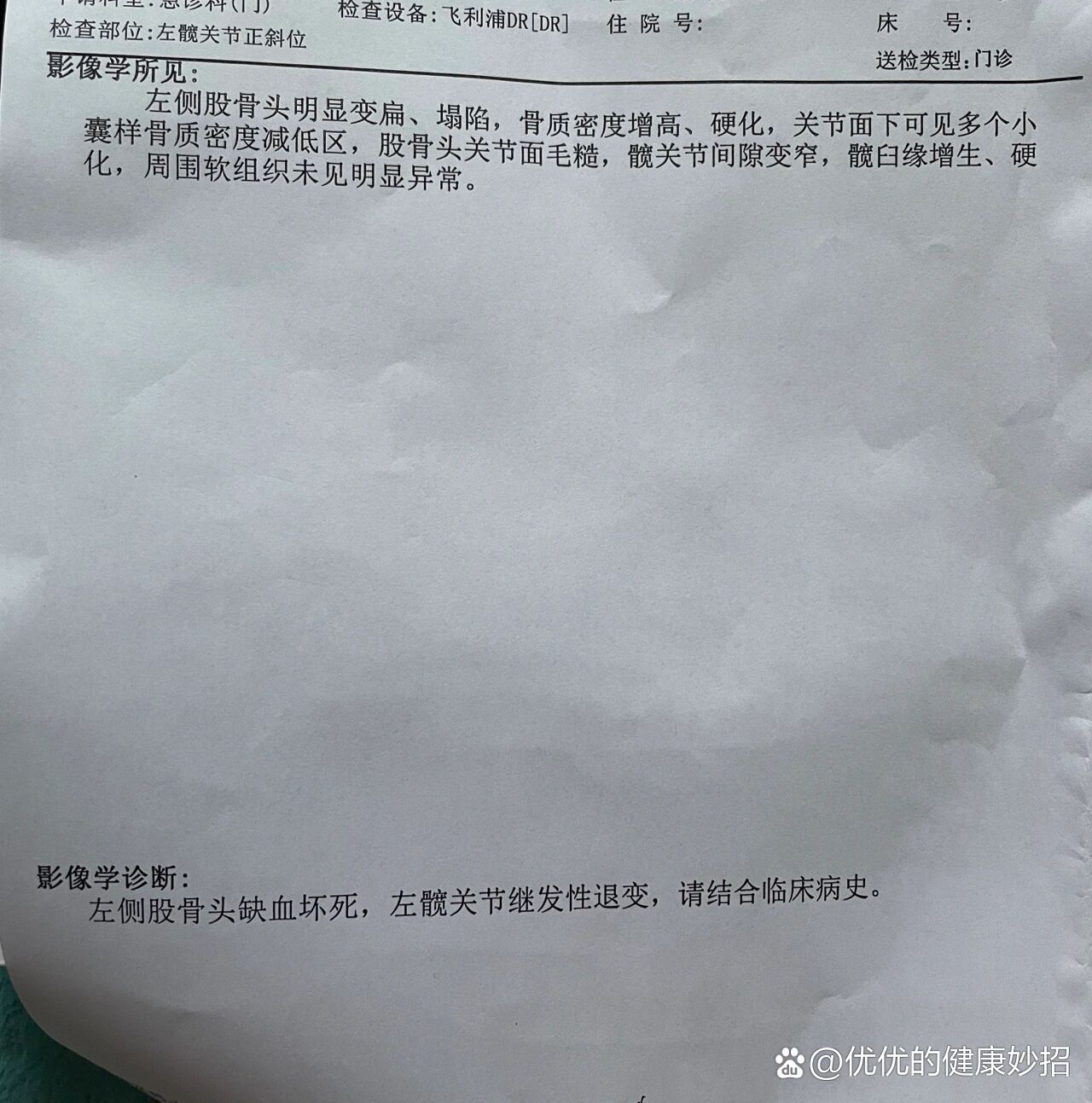 股骨头坏死