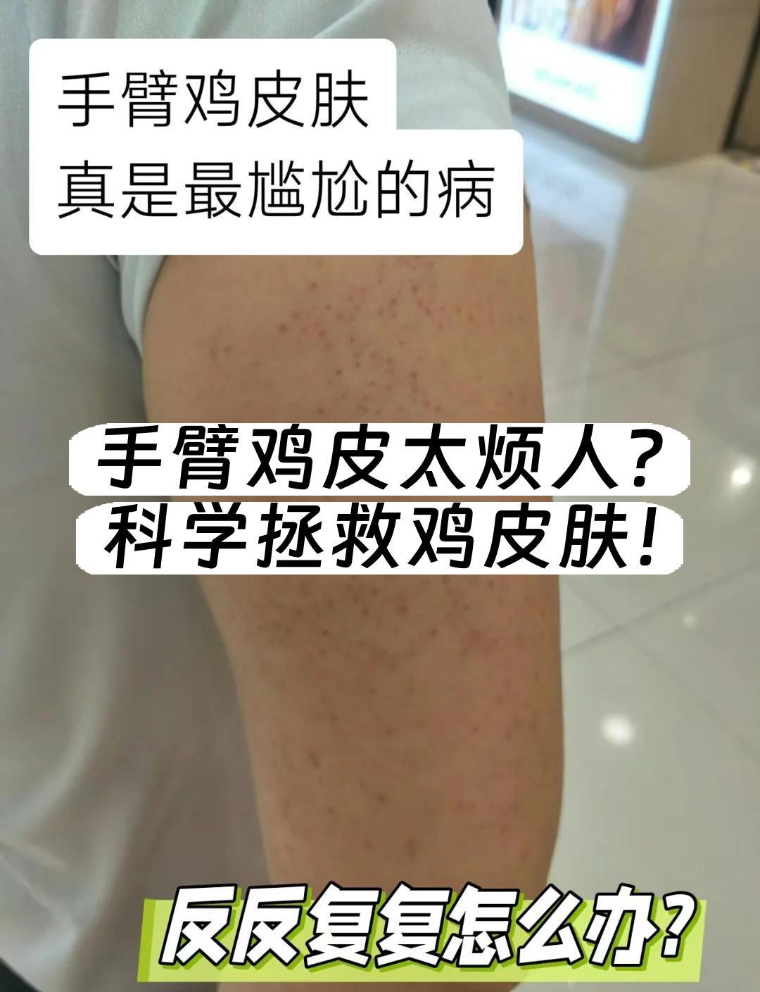 手臂鸡皮太烦人？