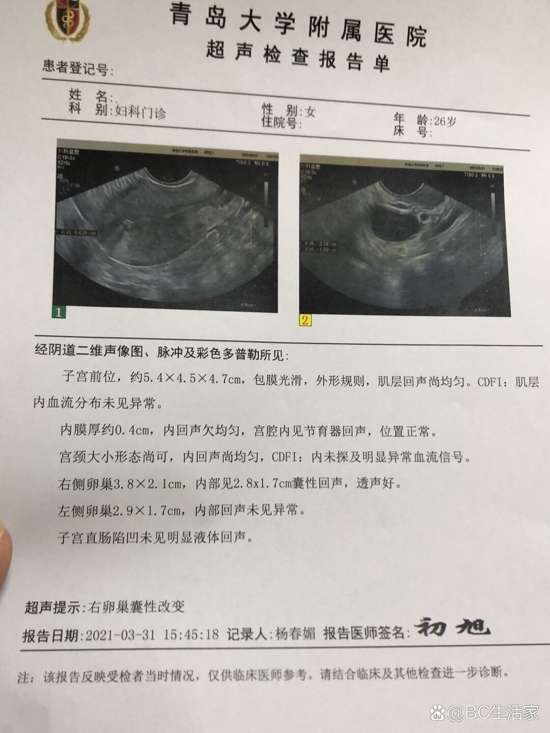曼月乐环复查