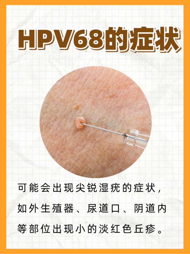 hpv68阳性,她如何成功转阴?