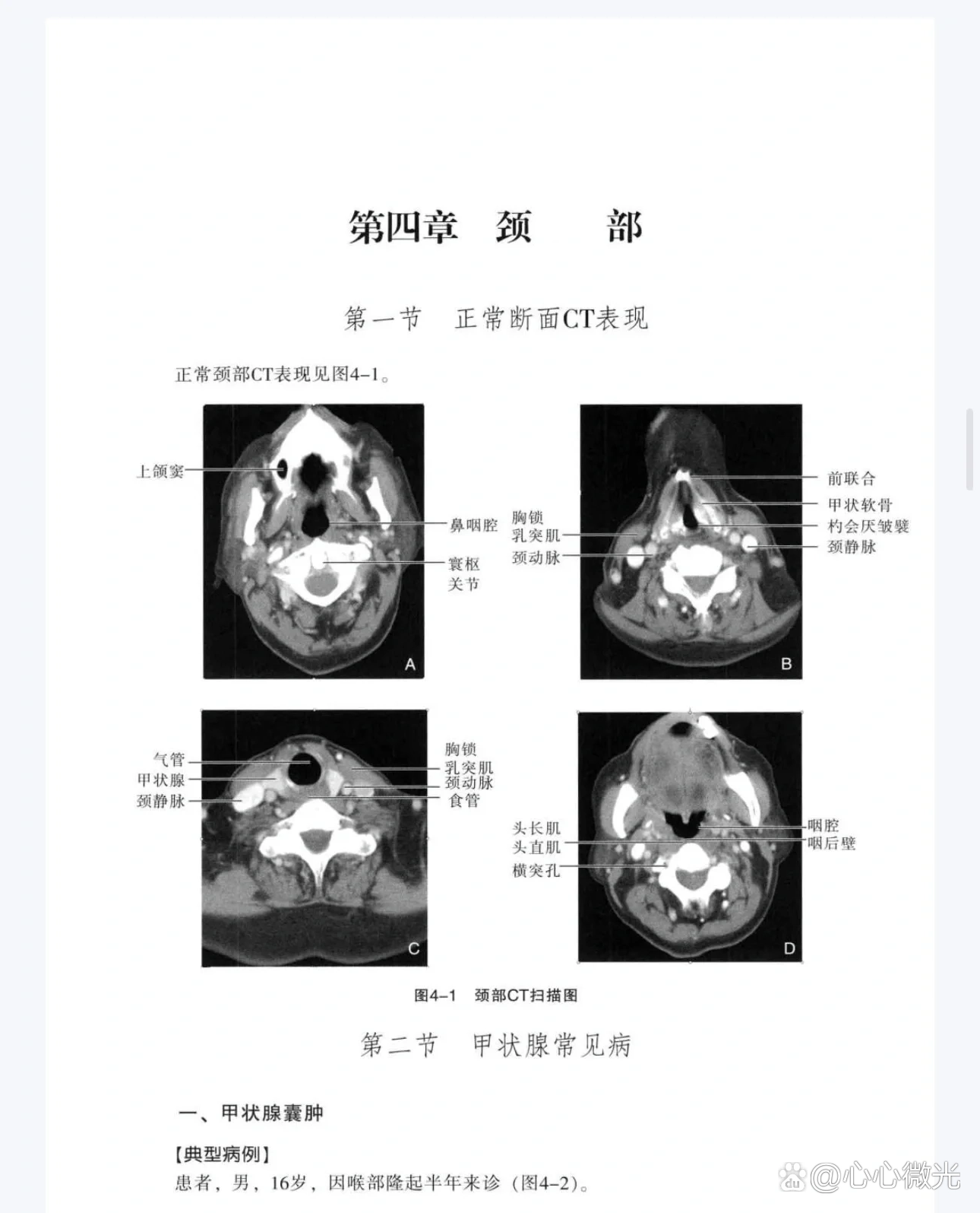 头颈部CTA解剖图片