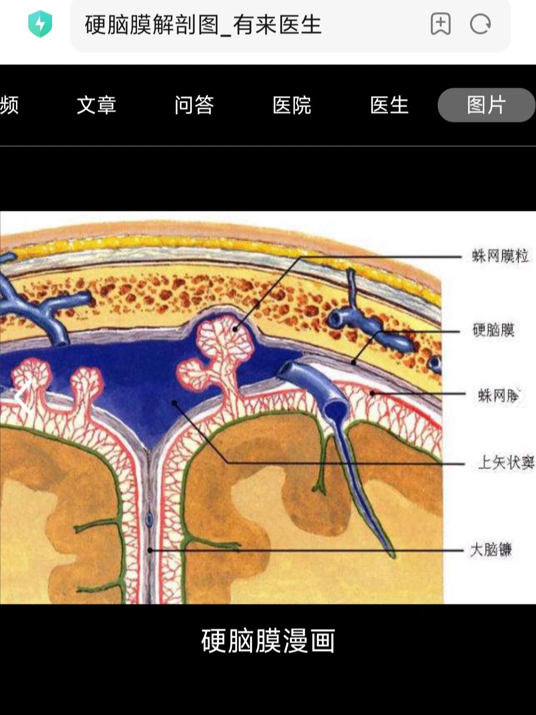 硬膜和蛛网膜的解剖图图片